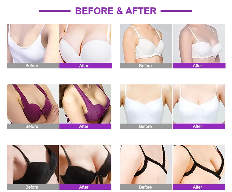 Urządzenie do powiększania piersi z podciśnieniowym podnoszeniem pośladków 4